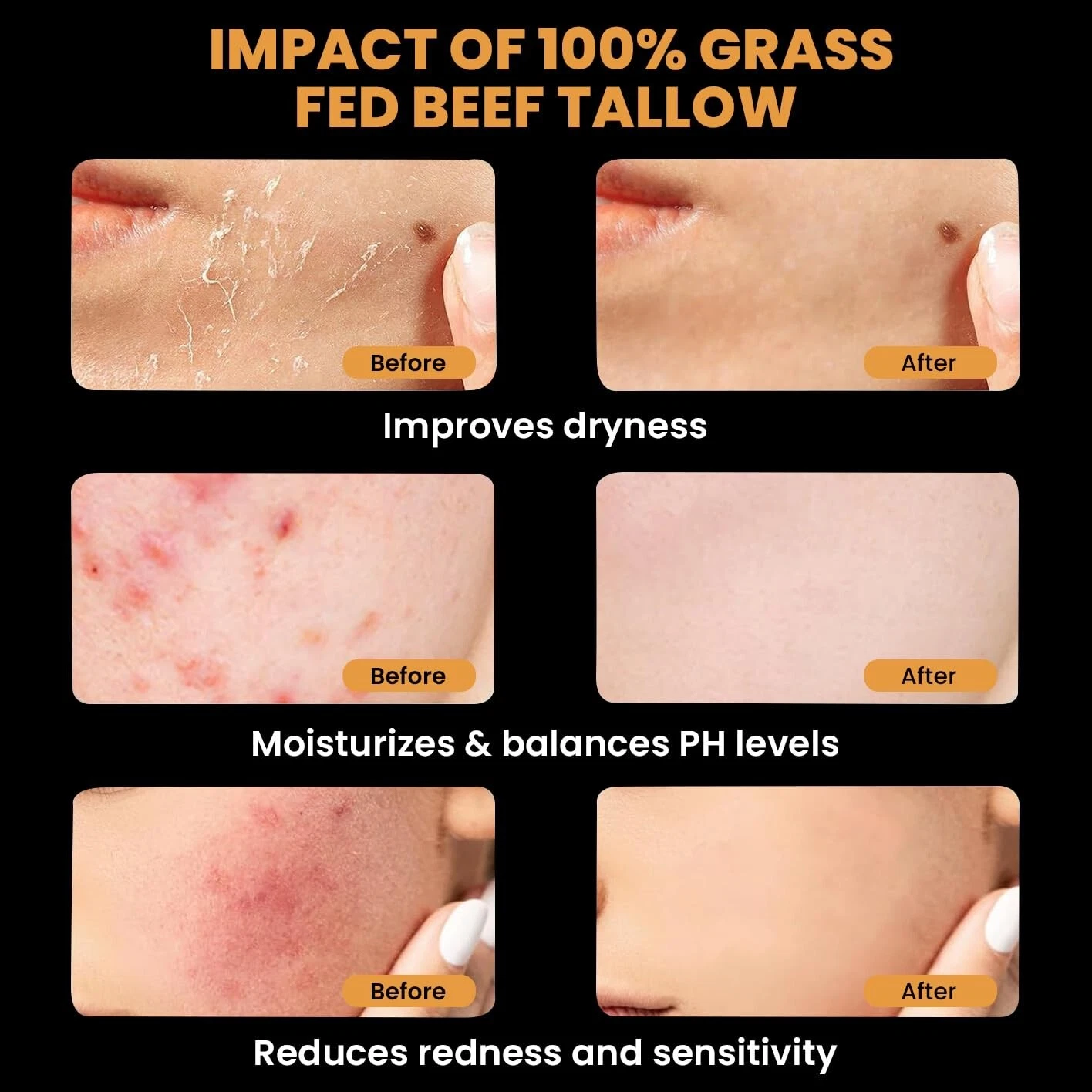 🔥 Last Day: 50% Off! 🔥 Organic Grass-Fed Tallow Balm with Raw Honey - Premium Moisturizer for Soft, Smooth Skin, Reduces Stretch Marks and Wrinkles - Handcrafted All-Natural Solution