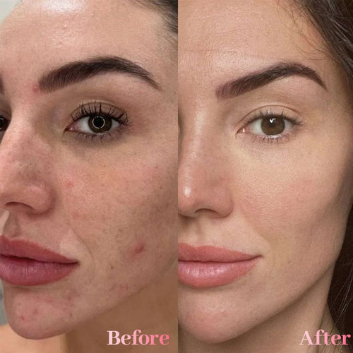 🔥 60% OFF Today Only! Tiworld™ Spray Serum for Dullness, Dark Spots & Uneven skin tone, Korean skin care