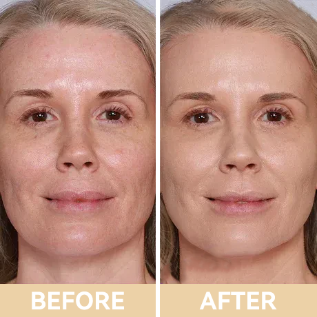 Only 3 Hours Left: 25% OFF 🔥Soft Matte Liquid Foundation