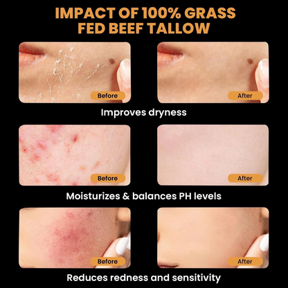 🔥 Last Day: 50% Off! 🔥 Organic Grass-Fed Tallow Balm with Raw Honey - Premium Moisturizer for Soft, Smooth Skin, Reduces Stretch Marks and Wrinkles - Handcrafted All-Natural Solution